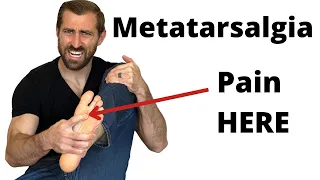 Strengthening Exercises for Metatarsalgia | Physical Therapy Treatment