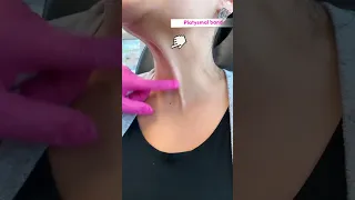 Botox for neck lines?! 💉Check this out! ✨💖