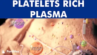 Platelet Rich Plasma - PRP - Tissue regeneration ©