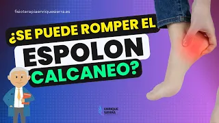 ¿SE PUEDE ROMPER EL ESPOLÓN CALCÁNEO? 👣💢