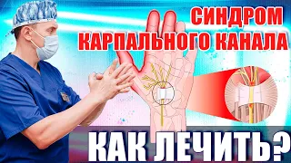 Синдром карпального канала - правильное лечение!