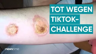 Warnung vor lebensgefährlicher TikTok-Challenge mit Deos