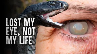 How to Survive a Spitting Cobra Attack