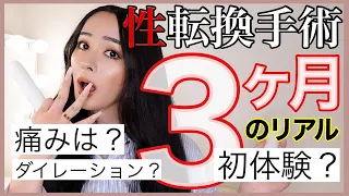 【性転換手術】術後3ヶ月経ったけどぶっちゃけ実際どうなの？