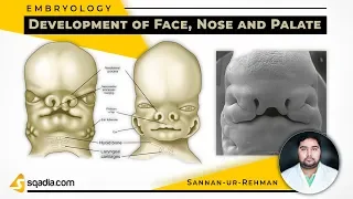 Development of Face, Nose and Palate | Embryology Lectures | Medical Student | V-Learning