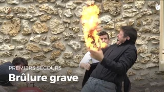 Premiers secours : Brûlure grave | Secourisme