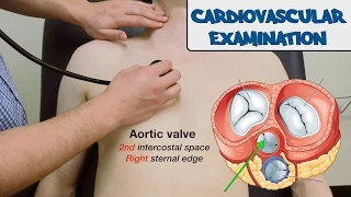 Cardiovascular Examination - OSCE Guide (old version) | UKMLA | CPSA