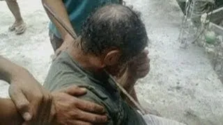 Man survives after metal rod pierces his neck in Brazil