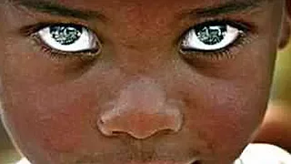 Rarest Eye Color in Humans