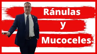 CAUSES OF MUCOCELES. CAUSES OF RANULAS. 𝟐 TRAUMATIZED SALIVARY GLANDS