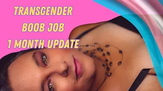 BREAST AUGMENTATION 1 MONTH UPDATE (TRANSGENDER WOMAN)  🏳️‍⚧️ KATE MADDEN VANCOUVER