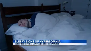 The sleepy signs of hypersomnia