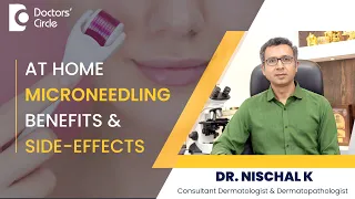 Watch this before you use At Home Micro Needling Tool/ Derma Roller - Dr. Nischal K |Doctors' Circle