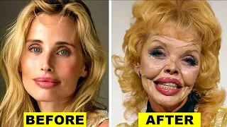 20 Times Plastic Surgery Went Horribly Wrong