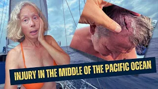 Passage to French Polynesia and a bad injury! Part 1