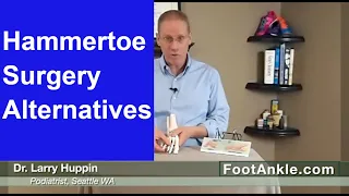 Watch This Video Before Having Hammertoes Surgery – Seattle Podiatrist Larry Huppin