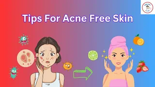 Follow These Tips To Reduce Acne