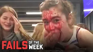 Watch The Face! Fails of the Week | FailArmy