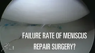 Failure rates of meniscus repair