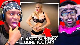 SIDEMEN REACT TO PLASTIC SURGERY GONE TOO FAR?