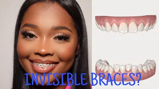 INVISIBLE BRACES? INVISALIGN FIRST IMPRESSIONS, PRICE, EFFECTIVENESS