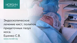 Эндоскопическое лечение ЛОР-патологии - удаление кист, полипов придаточных пазух носа