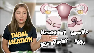 Tubal Ligation Surgery | What you need to know? | Pagpapa-Ligate Pagkapanganak | House Caaan