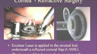 Medical School Pathology 2012 Session 076 Eye.mp4