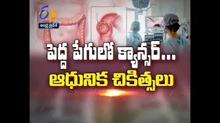 Modern Treatments For Colon Cancer | Sukhibhava | 26th July 2021 | ETV Andhra Pradesh