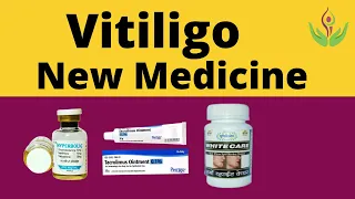 Best & New Medicine For Vitiligo (White Patches) in India | Care Well Medical Centre