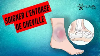 SOIGNER L'ENTORSE DE CHEVILLE [Conseils et exercices]