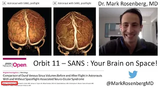 Orbit 11 - SANS : Your Brain on Space!