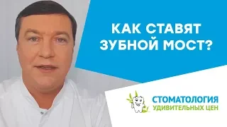 Как ставят зубной мост? Мост на задние и передние зубы.