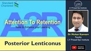 A2R: #016 (Posterior Lenticonus)