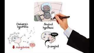 Pharmacology - DRUGS FOR ALZHEIMER'S DISEASE (MADE EASY)