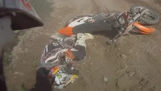 Broken wrist motocross crash