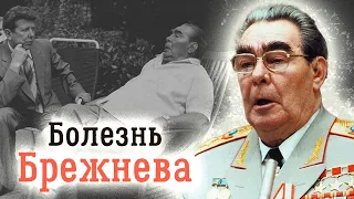 История болезни Брежнева. Какой диагноз врачи ставили генсеку