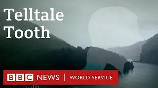 The Isdal Woman's telltale tooth, Death in Ice Valley, Episode 4 - BBC World Service