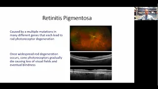 Mechanisms of Cone Cell Death in Retinitis Pigmentosa by Peter Campochiaro, MD | UCI CTVR