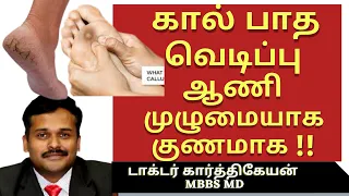 corn callus foot crack kaal aani patha vedippu in tamil|கால் ஆணி பாத வெடிப்பு குணமாக|dr karthikeyan