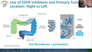 Patient Education Session (March 2023) - The Management of Metastatic Colorectal Cancer