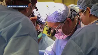Mass. man gets world's first genetically-edited pig kidney transplant