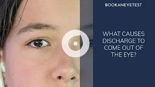 Eye Discharge | Eye Boogers | Sleep in Your Eyes | What Causes eye discharge | Book an eye test