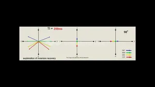 explanation of inversion recovery in MRI