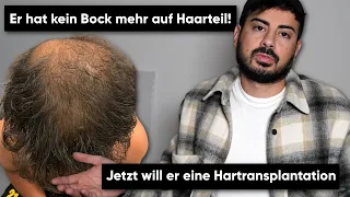 Er ist eigentlich nicht geeignet für eine Haartransplantation...