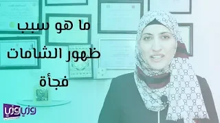 ما هو سبب ظهور الشامات فجأة