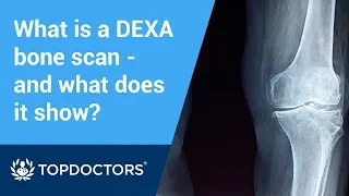 What is a DEXA bone scan and what does it show?