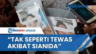 JANGGAL! Saksi Ahli Sebut Kulit Jasad Mirna Berwarna biru: Tak Mencirikan Tewas akibat Sianida