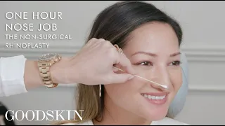 One-Hour Nose Job: The Non-Surgical Rhinoplasty | GOODSKIN