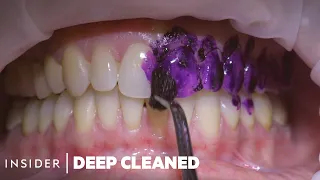 How 5 Body Parts Are Professionally Deep Cleaned | Deep Cleaned